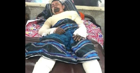 বড়লেখায় অগ্নিদগ্ধ আগর শ্রমিকের মৃত্যু