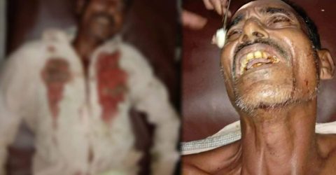 গভীর রাতে দুর্বৃত্তদের হামলা ; গুরুতর আহত-১