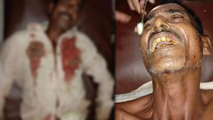 গভীর রাতে দুর্বৃত্তদের হামলা ; গুরুতর আহত-১