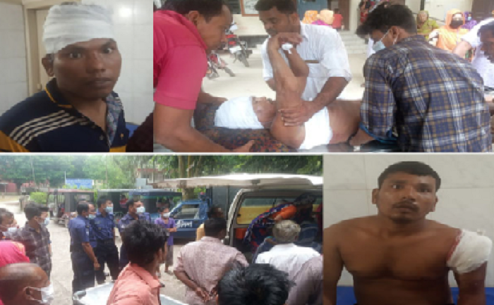 মেহেরপুরে ছোট ভাইয়ের হামলায় বড় ভাই জখম: থানায় মামলা