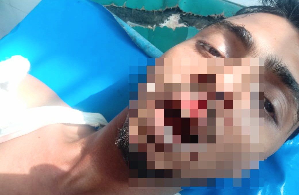 আদালত থেকে ফেরার পথে শান্তিগঞ্জের ২ যুবকের উপর হামলা