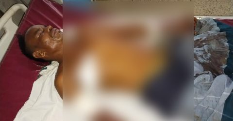 শান্তিগঞ্জে সংঘবদ্ধ হামলার অভিযোগ, আশঙ্কাজনক অবস্থায় হাসপাতালে একজন